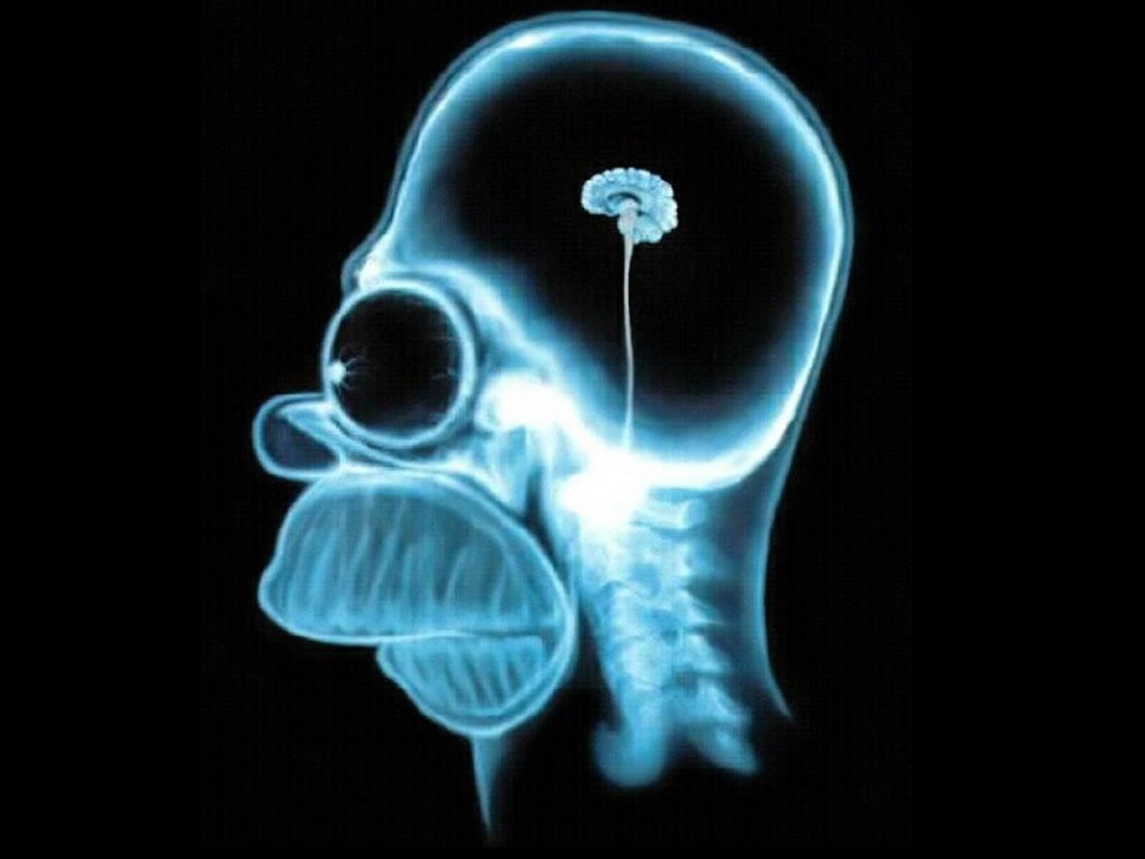 X-ray image of Homer Simpson's head from the TV show The Simpsons, humorously depicting a very small brain inside his skull.