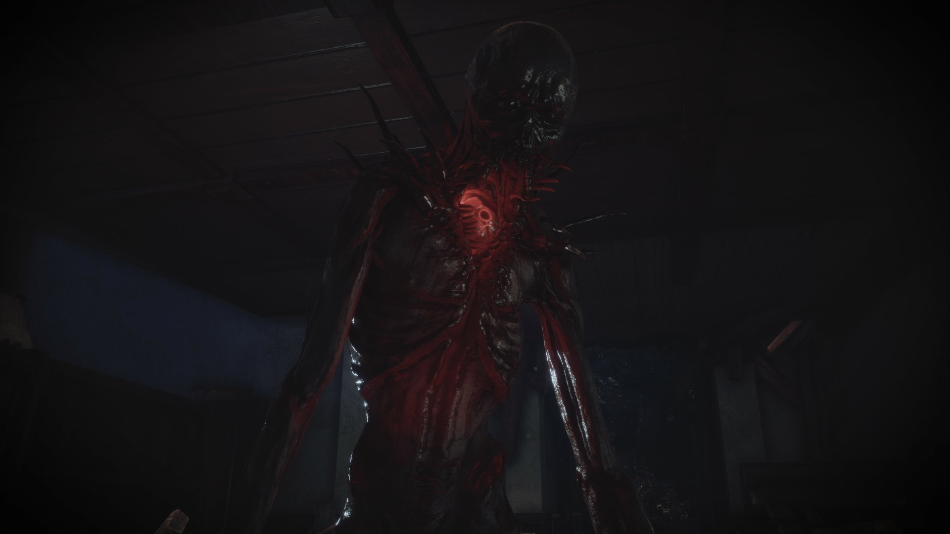 video game Fobia - St. Dinfna Hotel Image